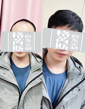 各類無(wú)痕接發(fā)定制